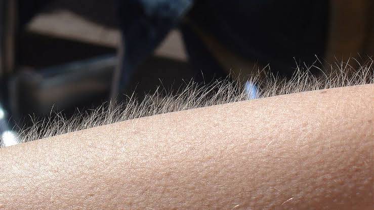 Why do we get goosebumps?