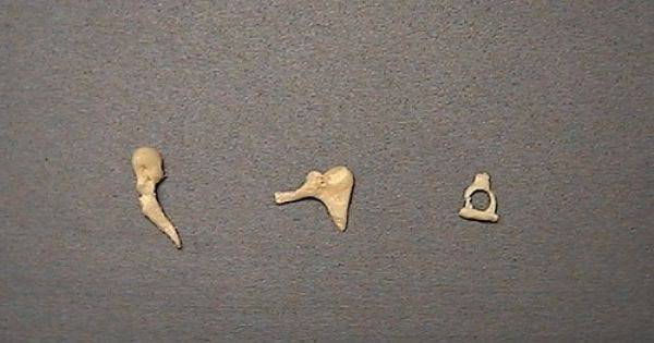 What is the smallest bone in the body?