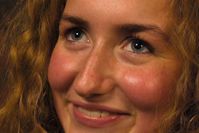 Why does our face get red when we’re embarrassed?