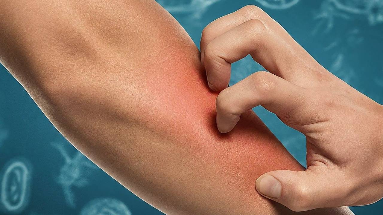 Why do we itch?
