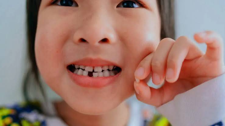 Why do we lose teeth as children?